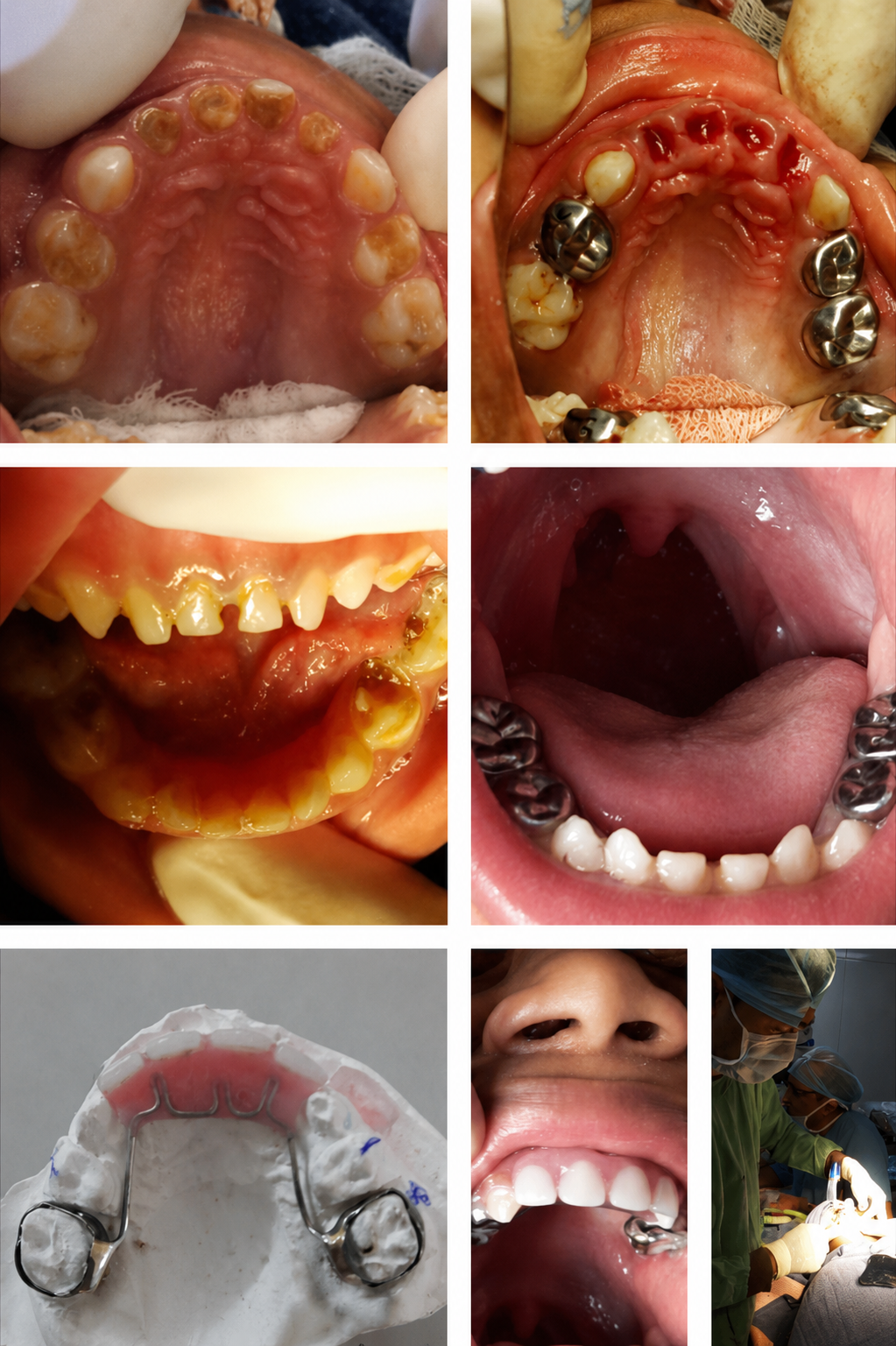 Comfortable Pediatric Dental Chairs in Atlanta