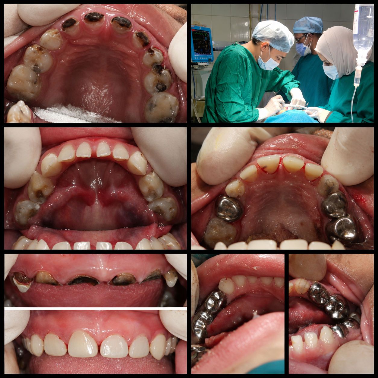 Dr. Kanumuri MDS Clinic - Best Pediatric Dentist